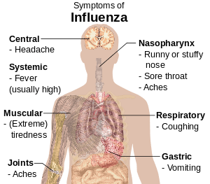 300px Symptoms of influenza.svg 2